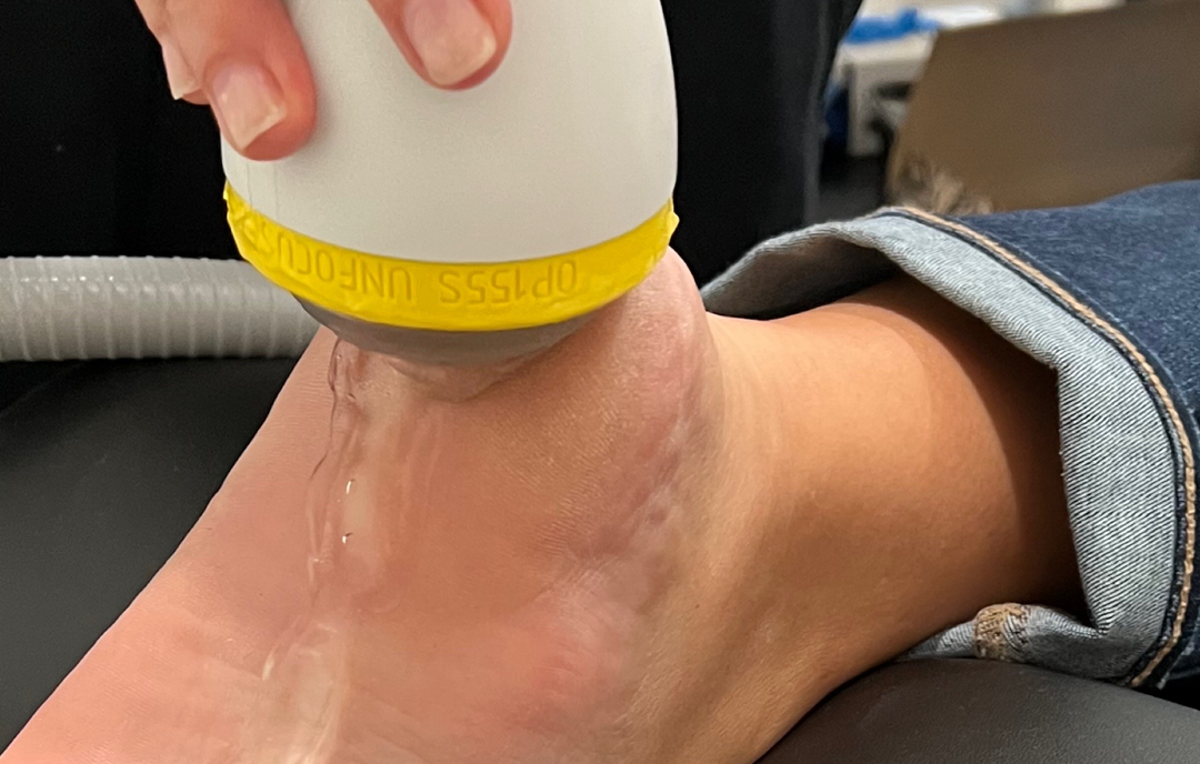 Advancing Heel Pain Treatment with SoftWave Therapy at Cedar Park Chiropractic and Acupuncture